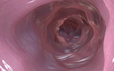 It May Be Safe to Extend Time Between Colonoscopy Screenings, Study Says