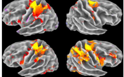 EEG signatures of cognitive decline after mild SARS-CoV-2 infection: an age-dependent study