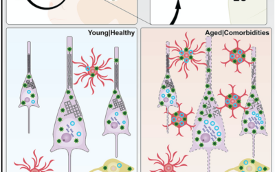 SARS-CoV-2 infects neurons and induces neuroinflammation in a non-human primate model of COVID-19