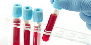 CRC Screening in Primary Care: The Blood Test Option