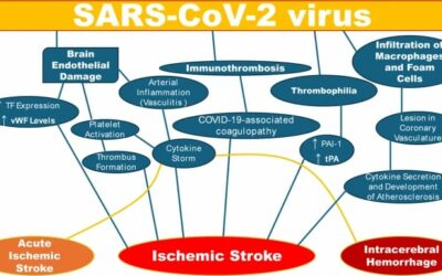 Stroke risks in patients with COVID‐19: multiple mechanisms of SARS‐CoV‐2, impact of sex and age, vaccination, and long‐term infection