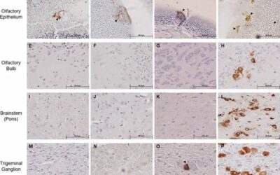 Characterizing neuroinvasion and neuropathology of SARS-CoV-2 by using AC70 human ACE2 transgenic mice