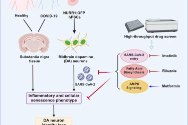 SARS-CoV-2 infection causes dopaminergic neuron senescence