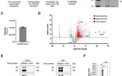 SARS-CoV-2 hijacks host CD55, CD59 and Factor H to impair antibody-dependent complement-mediated lysis