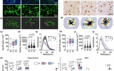 Emerging signs of Alzheimer-like tau hyperphosphorylation and neuroinflammation in the brain post recovery from COVID-19